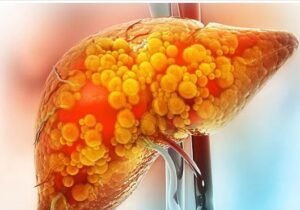 Artificial sweeteners